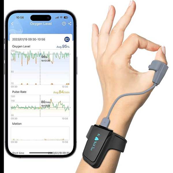 پالس اکسیمتر مچی هوشمند ویاتوم Checkme O2 Max