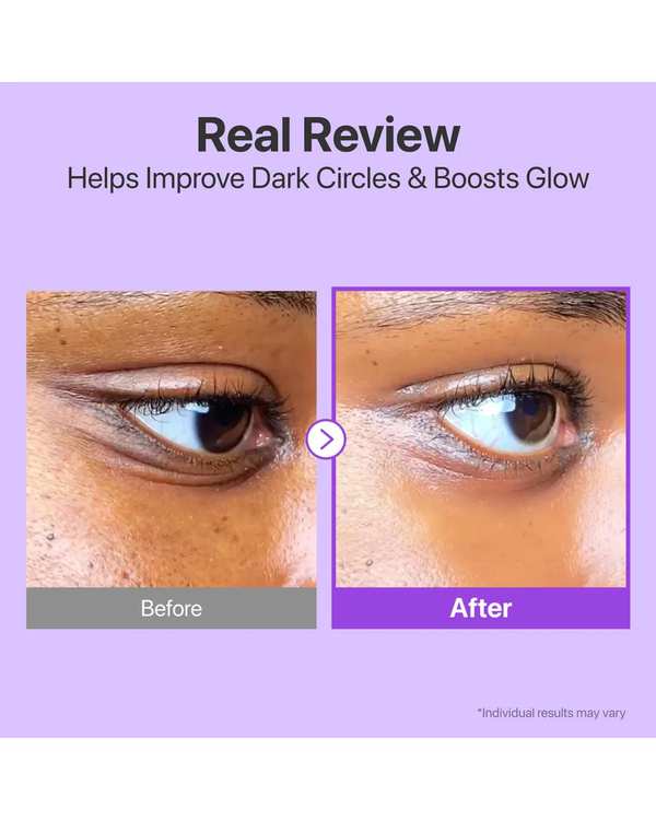 کرم دور چشم NAD+ رتینول نامبوزین Numbuzin ضدچروک و جوانساز دور چشم سری No.9 NAD+ مدل Retinol Volumetox Eye Cream حجم 10 میلی لیتر - تصویر 2