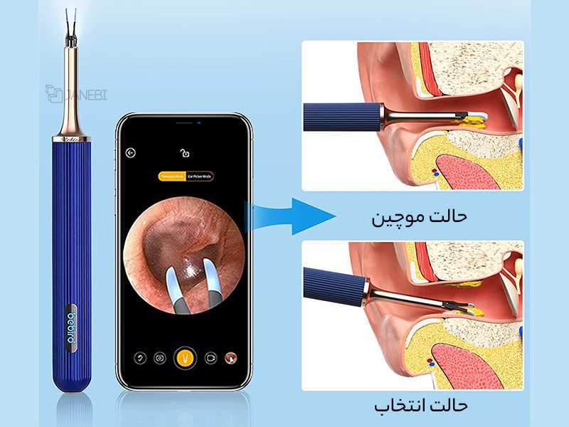 گوش پاک کن هوشمند شیائومی  Xiaomi Bebird Note 3 Pro 3 in 1 multifunctional earwax removal