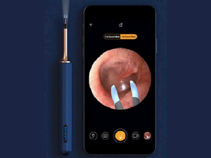 گوش پاک کن هوشمند شیائومی  Xiaomi Bebird Note 3 Pro 3 in 1 multifunctional earwax removal