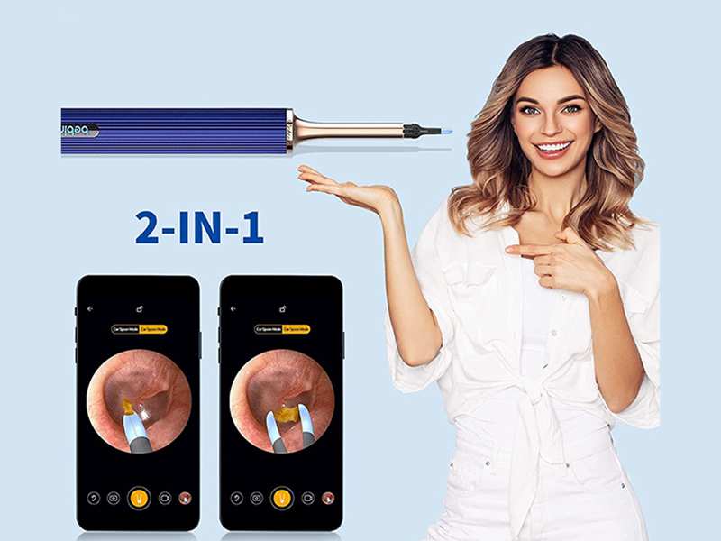 گوش پاک کن هوشمند شیائومی  Xiaomi Bebird Note 3 Pro 3 in 1 multifunctional earwax removal