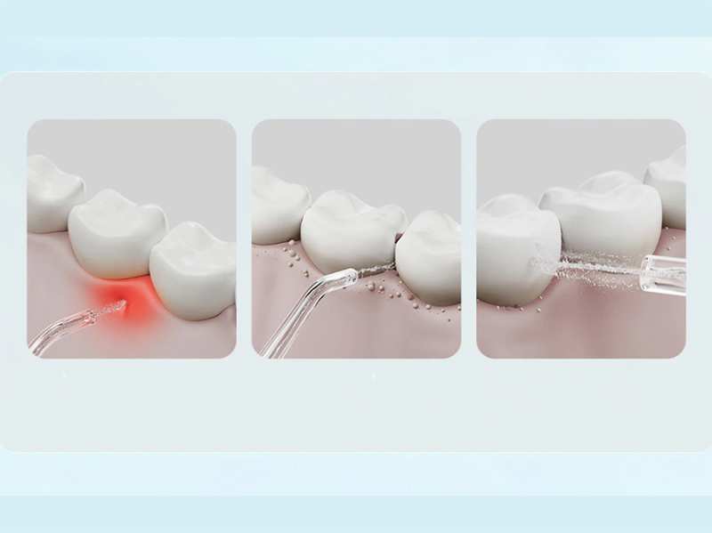 دستگاه شست و شوی دهان و دندان شیائومی Xiaomi Mijia Electric Oral Irrigation F300 MEO703 Dental Irrigator Teeth
