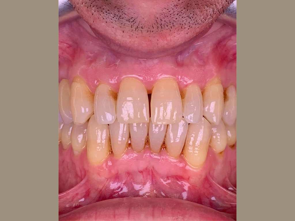 چراغ دوقلوی تصویربرداری دندان پزشکی اسینو OSiNO dental twin light MK-016