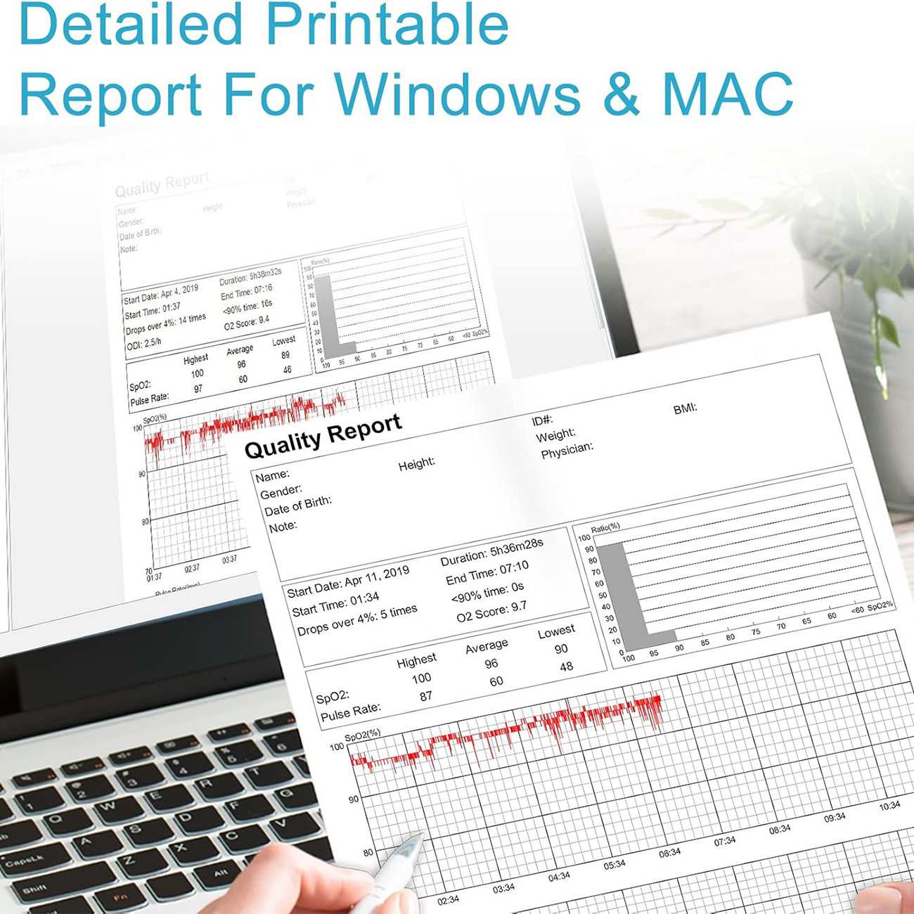 پالس اکسیمتر مچی هوشمند ویاتوم Checkme O2