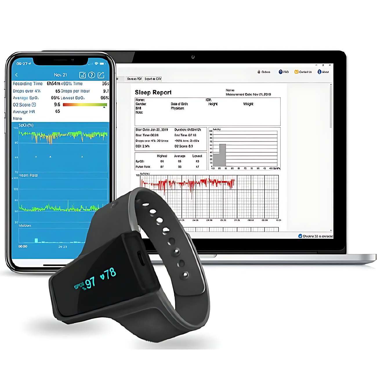 پالس اکسیمتر مچی هوشمند ویاتوم Checkme O2