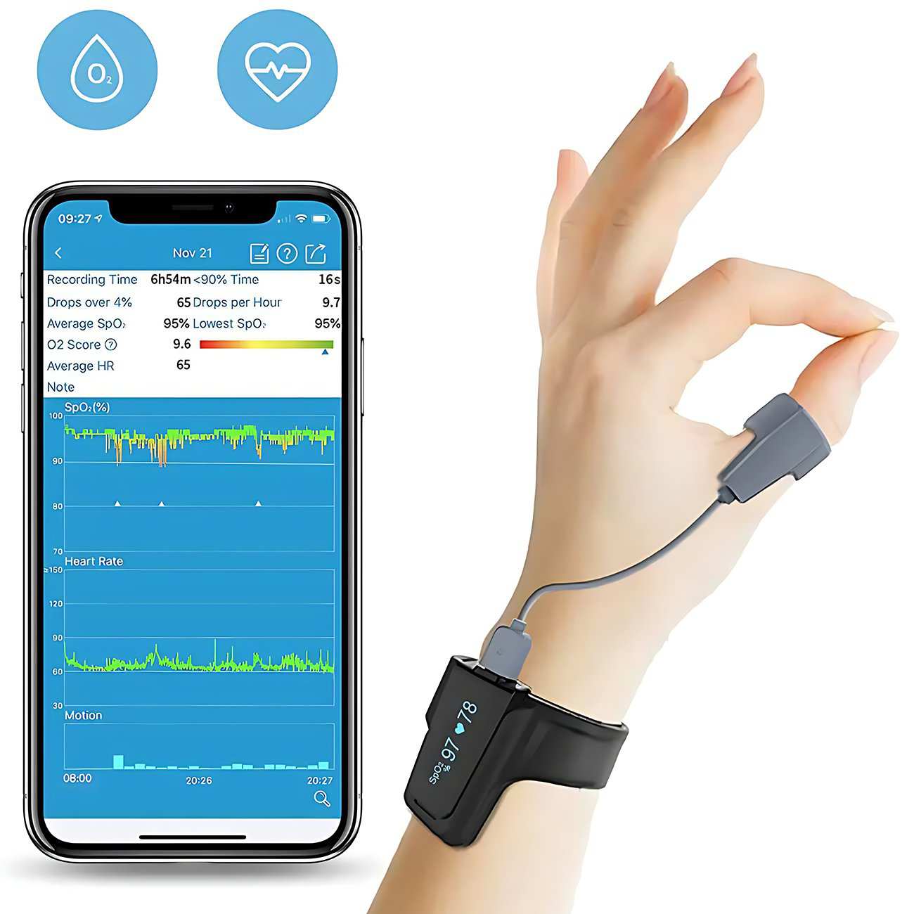 پالس اکسیمتر مچی هوشمند ویاتوم Checkme O2