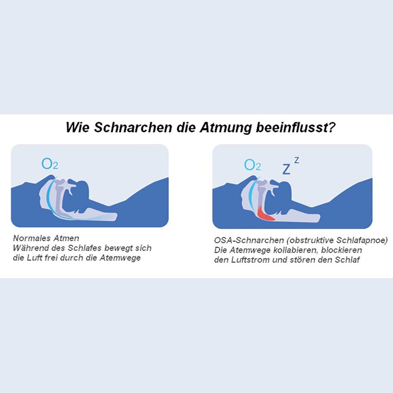 پالس اکسیمتر مچی هوشمند ویاتوم Checkme O2 Max