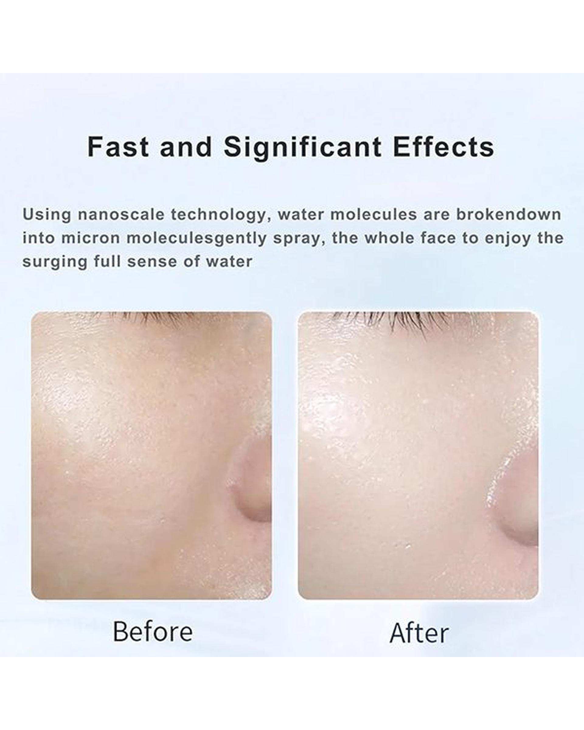 دستگاه آبرسان پوست سفید ام دی اچ ال Mdhl مدل md-6999