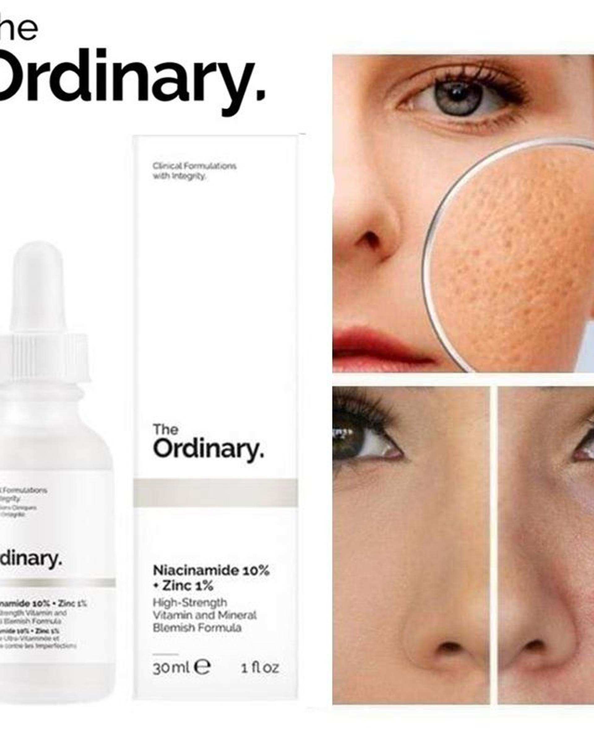 سرم پوست اوردینری The Ordinary مدل 1% Niacinamide 10% + Zinc حجم ۳۰ml