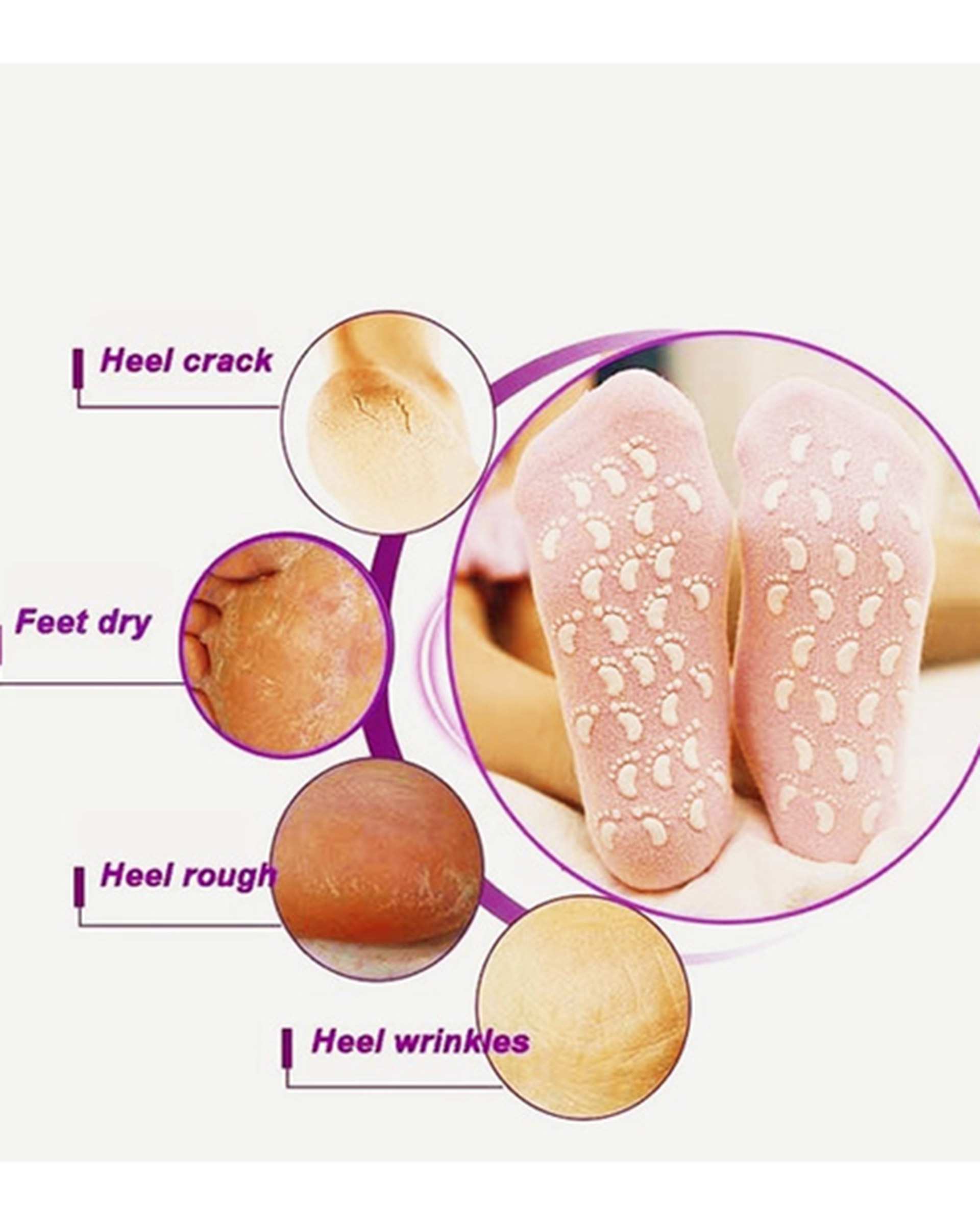 جوراب سیلیکونی ژله ای ترک پا مشکی سورا Sora