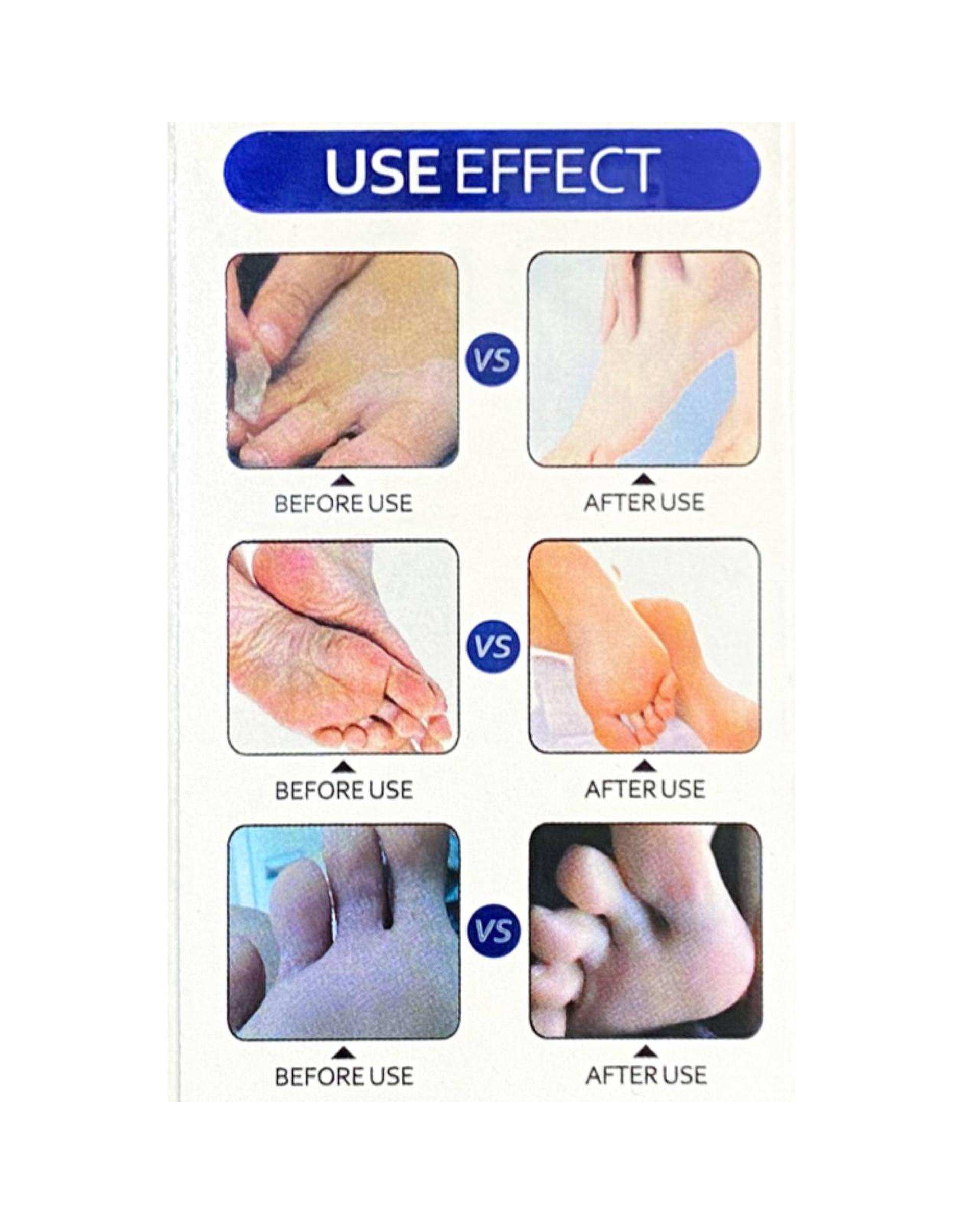 اسپری رفع ترک پا راکو Rako مدل ویتامین E حجم 150ml