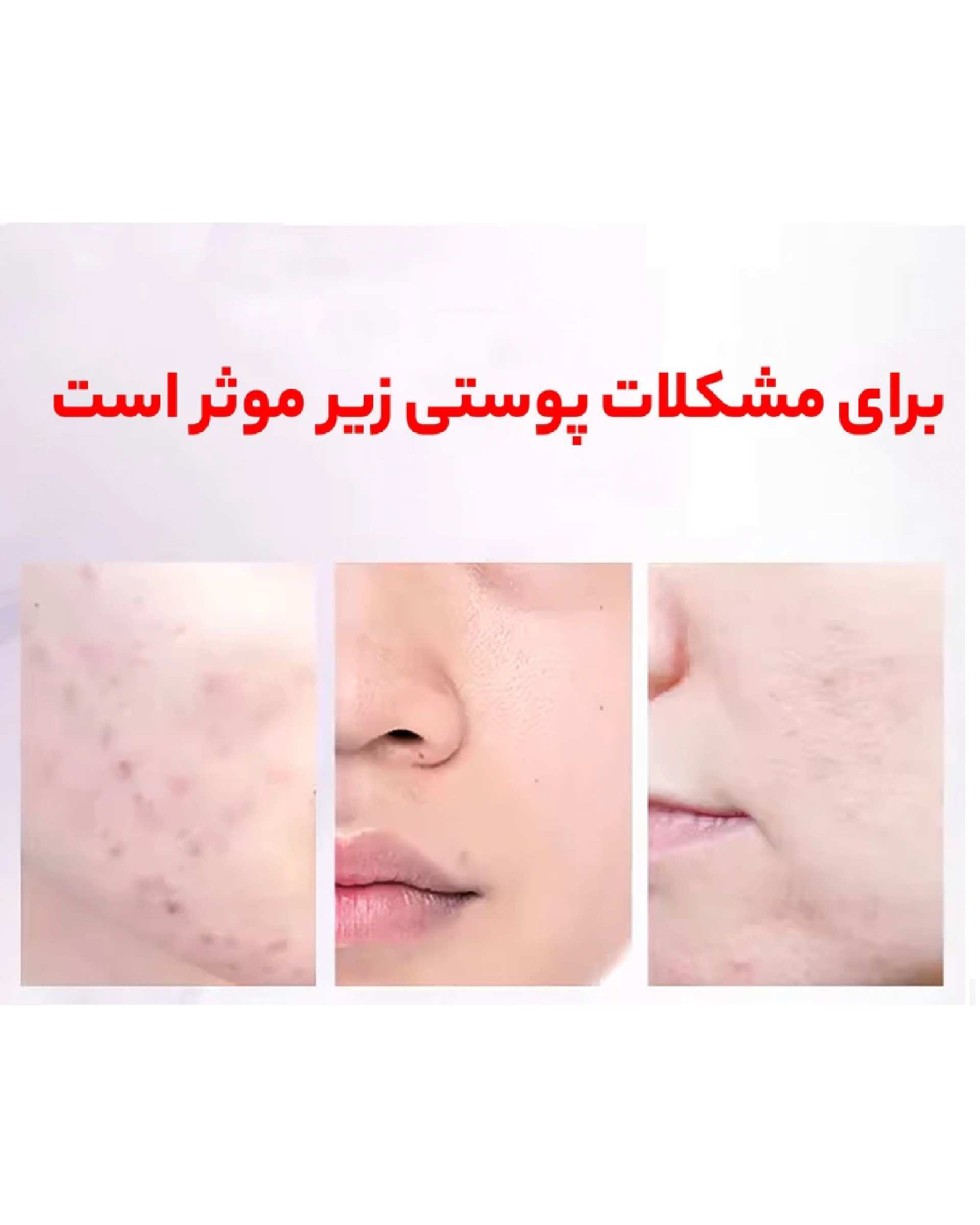 تونر پاک کننده صورت سرسان لاو SersanLove مدل هلو حجم 400 میلی لیتر