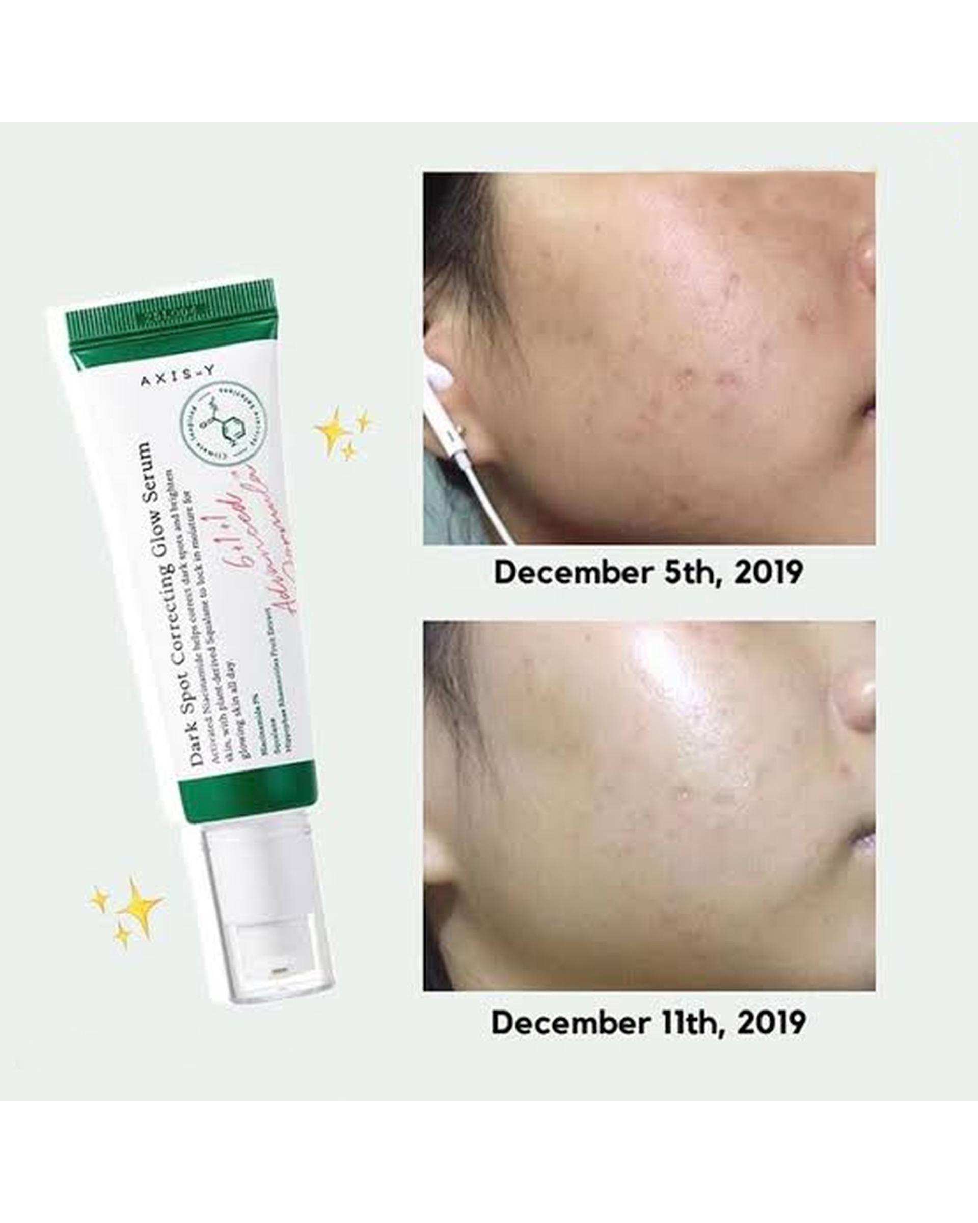 سرم ضد لک اکسیس وای AXIS Y مدل Dark Spot Correcting Glow Serum حجم 50 میلی لیتر