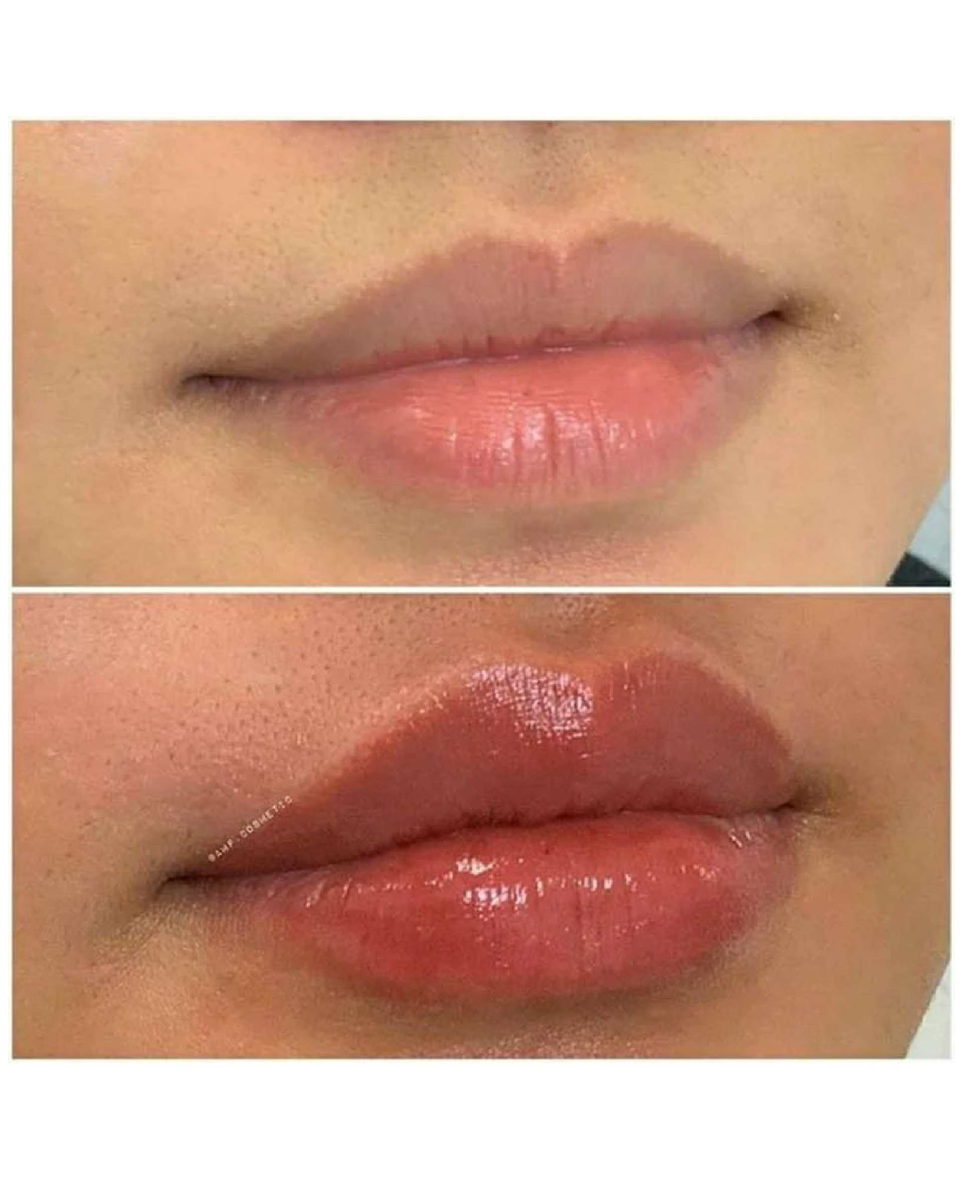 حجم دهنده لب گابرینی Gabrini مدل 01